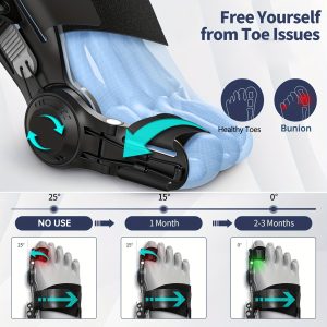 All-Day Comfort Premium Bunion Corrector Set - 4pcs Comfortable Toe Separators + 1pc Adjustable ABS Night Splint for Hallux Valgus | All-Day Comfort for Wide Feet & High-Heel Wearers | Christmas & Valentine Gift Kit, Hallux valgus Schiene, best deal